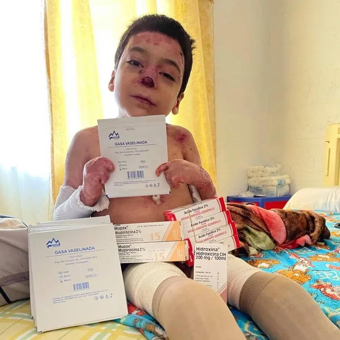 Baby Noah’s Fight Against Epidermolysis Bullosa: A Journey of Hope and Healing