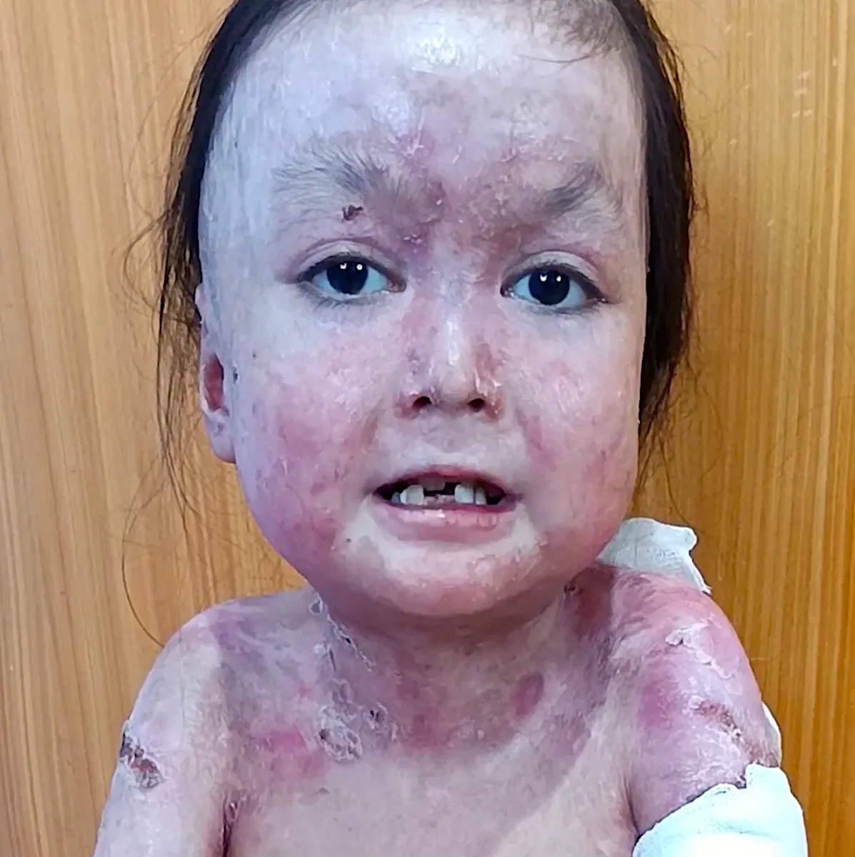 Please Donate to Stop Shamila's Severe Pain and Help Save Her Life