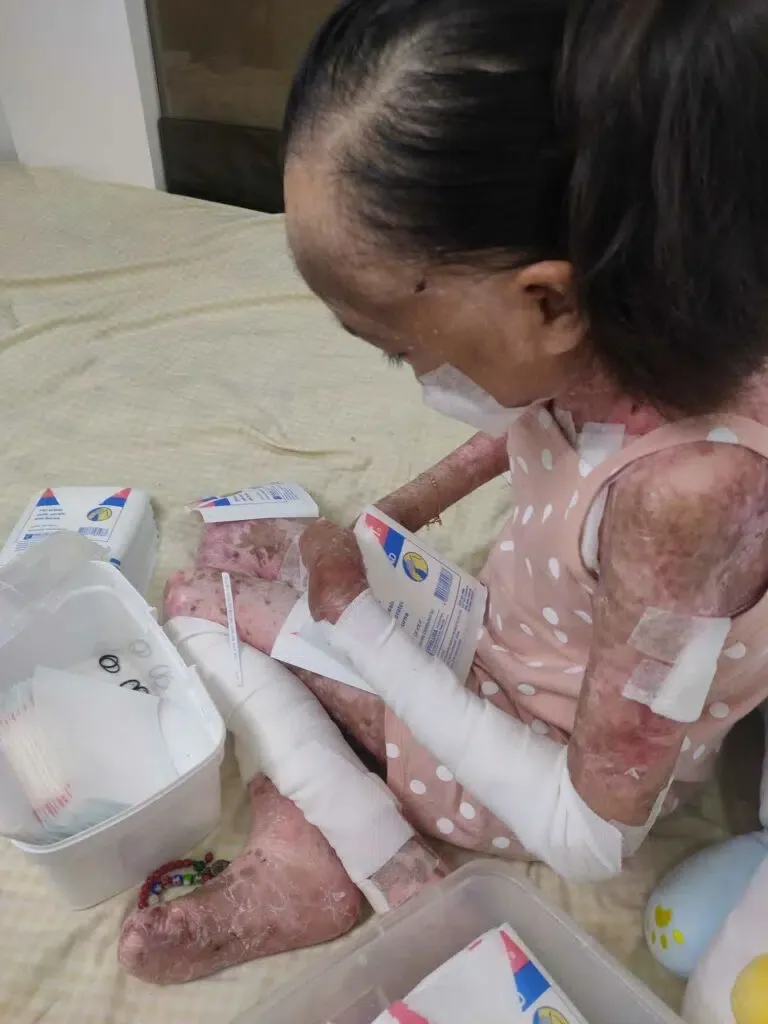 Fighting Through the Challenges of Epidermolysis Bullosa